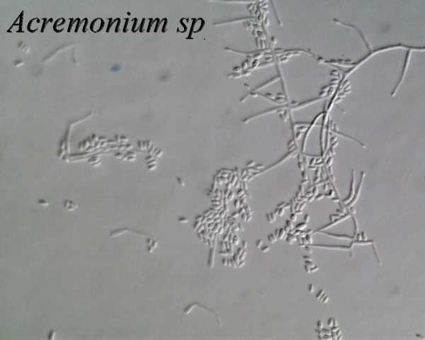 acremonium sp